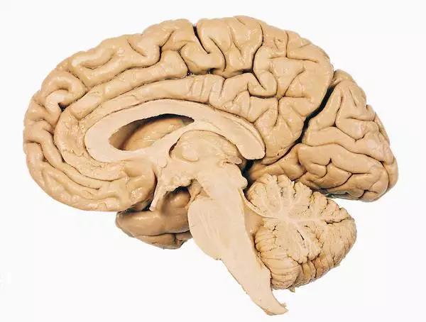 馬斯克腦機(jī)融合系統(tǒng)Neuralink